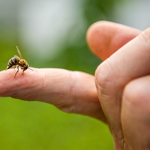 What is anaphylaxis?